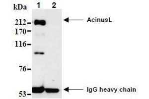 Western Blotting (WB) image for anti-Apoptotic Chromatin Condensation Inducer 1 (ACIN1) (AA 1-523), (N-Term) antibody (ABIN1105223)