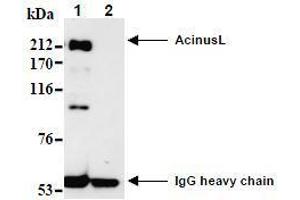 Western Blotting (WB) image for anti-Apoptotic Chromatin Condensation Inducer 1 (ACIN1) (AA 1-523), (N-Term) antibody (ABIN1105223) (ACIN1 anticorps  (N-Term))
