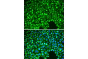 Immunofluorescence analysis of HeLa cells using NFKBIA antibody (ABIN5998337). (NFKBIA anticorps)