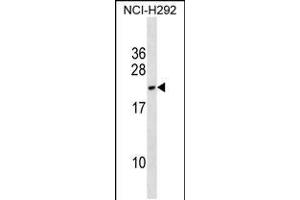 Western blot analysis in NCI-H292 cell line lysates (35ug/lane). (DYDC2 anticorps  (C-Term))