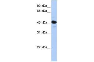 WB Suggested Anti-HSD11B2 Antibody Titration:  0. (HSD11B2 anticorps  (N-Term))