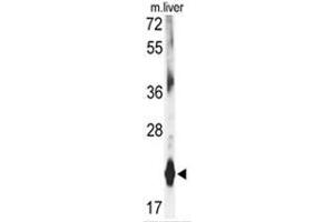 Western blot analysis of DHFR antibody (C-term) in mouse liver tissue lysates (35ug/lane). (Dihydrofolate Reductase anticorps  (C-Term))