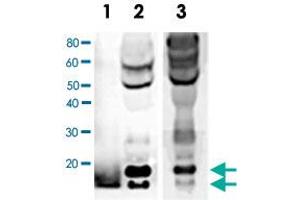 Western blot analysis of BDNF expression in human serum. (BDNF anticorps)
