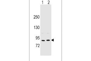 Western blot analysis in MCF-7(lane 1),A375(lane 2) cell line lysates (35ug/lane). (Periostin anticorps  (C-Term))