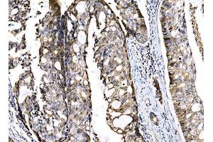 IHC analysis of Sigma1-Receptor/SIGMAR1 using anti-Sigma1-Receptor/SIGMAR1 antibody (ABIN7599011). (SIGMAR1 anticorps  (AA 1-154))