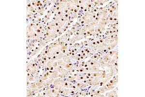 Immunohistochemistry of paraffin embedded rat kidney using ZHX3 (ABIN7076287) at dilution of 1:700 (400x lens) (ZHX3 anticorps)