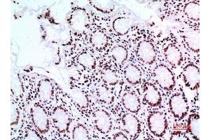 Immunohistochemistry (IHC) analysis of paraffin-embedded Human Colon, antibody was diluted at 1:100.