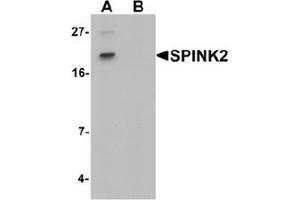 Western blot analysis of SPINK2 in mouse heart tissue lysate with SPINK2 Antibody  at 1 ug/mL in (A) the absence and (B) the presence of blocking peptide. (SPINK2 anticorps  (C-Term))