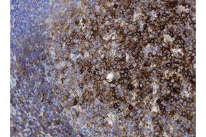 anti-Sex Determining Region Y (SRY) antibody