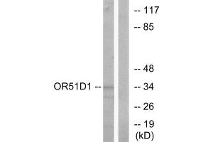 Western blot analysis of extracts from Jurkat cells, using OR51D1 antibody. (OR51D1 anticorps  (Internal Region))