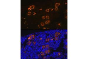Immunofluorescence analysis of mouse bone marrow using CXCL4/CXCL4/PF4 Rabbit mAb (ABIN1683188, ABIN3017983, ABIN3017984 and ABIN7101555) at dilution of 1:100 (40x lens). (PF4 anticorps)