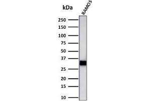 Western Blot Analysis of Ramos cell lysate using HLA-DR Mouse Monoclonal Antibody (LN-3 + HLA-DRB/1067). (HLA-DRB1 anticorps)