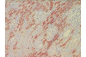 Immunohistochemical analysis of Human L-FABP in Frozen Human kidney tissue using FABP1 Antibody Cat.