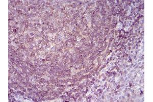 Immunohistochemical analysis of paraffin-embedded lymph tissues using APBB1IP mouse mAb with DAB staining.