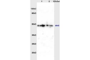 Lane 1: mouse brain lysates Lane 2: mouse embryo lysates probed with Anti phospho-C-Myc(Thr358) Polyclonal Antibody, Unconjugated (ABIN752593) at 1:200 in 4 °C. (c-MYC anticorps  (pThr358))