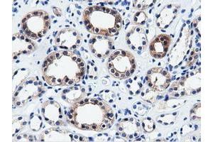 Immunohistochemical staining of paraffin-embedded Human liver tissue using anti-QPRT mouse monoclonal antibody. (QPRT anticorps)