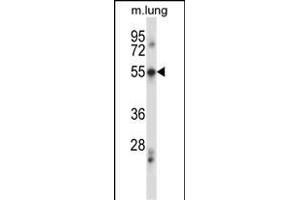 PDCD7 Antibody (C-term) (ABIN657501 and ABIN2846526) western blot analysis in mouse lung tissue lysates (35 μg/lane). (PDCD7 anticorps  (C-Term))