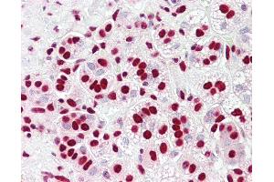 anti-Heterogeneous Nuclear Ribonucleoprotein K (HNRNPK) (AA 200-250) antibody