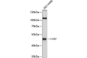 Western blot analysis of extracts of H460 cells, using LHX2 antibody (ABIN6128066, ABIN6143191, ABIN6143192 and ABIN6214989) at 1:1000 dilution.