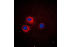Immunofluorescent analysis of CD1e staining in HeLa cells. (CD1e anticorps  (Center))