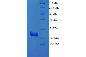 SDS-PAGE (SDS) image for Microtubule-Associated Protein tau (MAPT) (AA 24-195) protein (His tag) (ABIN5714056)