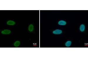 ICC/IF Image Histone H1. (Histone H1.3 anticorps  (Center))