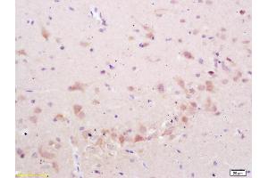 Formalin-fixed and paraffin embedded rat brain labeled with Anti-phospho-STMN2/SCG10 (Ser50) Polyclonal Antibody, Unconjugated (ABIN1714035) at 1:200 followed by conjugation to the secondary antibody and DAB staining (STMN2 anticorps  (pSer50))