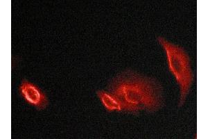 ABIN6269066 staining Hela cells by ICC/IF. (DAB1 anticorps  (Internal Region))