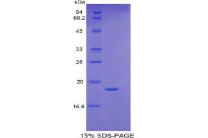 SDS-PAGE analysis of Human RBP5 Protein. (Retinol Binding Protein 5 Protéine)