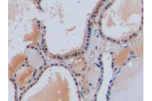 Detection of CHGA in Human Thyroid Tissue using Polyclonal Antibody to Chromogranin A (CHGA)