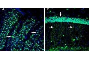 Expression of CD73 in mouse striatum and hippocampus.