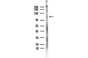 anti-Olfactomedin-Like 2B (OLFML2B) (Internal Region) antibody