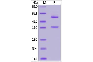 Human Glypican 2, Fc Tag on  under reducing (R) condition.