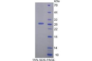 Image no. 1 for Signaling Lymphocytic Activation Molecule Family Member 1 (SLAMF1) (AA 17-227) protein (His tag) (ABIN6238132) (SLAMF1 Protein (AA 17-227) (His tag))