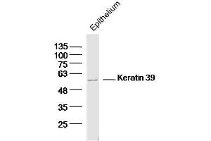 Mouse epithelium lysates probed with Keratin 39 Polyclonal Antibody, Unconjugated  at 1:300 dilution and 4˚C overnight incubation. (Keratin 39 (KRT39) (AA 401-491) anticorps)