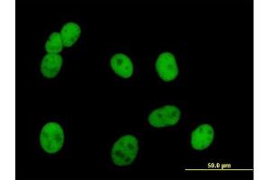 Immunofluorescence of purified MaxPab antibody to PMS2 on HeLa cell. (PMS2 anticorps  (AA 1-862))
