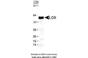 Image no. 1 for anti-Lysyl Oxidase (LOX) (AA 200-300), (AA 300-400) antibody (ABIN363535) (LOX anticorps  (AA 200-300, AA 300-400))