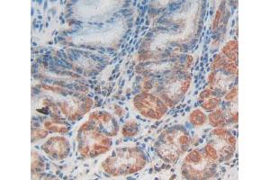 IHC-P analysis of Human Tissue, with DAB staining. (CCBL1 anticorps  (AA 1-422))
