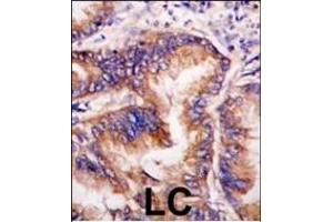 anti-Eukaryotic Translation Initiation Factor 2-alpha Kinase 1 (EIF2AK1) (AA 267-296) antibody
