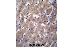 AKR1C2 Antibody (C-term) (ABIN656180 and ABIN2845509) immunohistochemistry analysis in formalin fixed and paraffin embedded human liver tissue followed by peroxidase conjugation of the secondary antibody and DAB staining. (AKR1C2 anticorps  (C-Term))