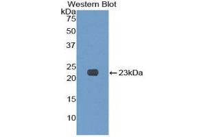Western Blotting (WB) image for anti-Killer Cell Lectin-Like Receptor Subfamily C, Member 2 (KLRC2) (AA 19-190) antibody (ABIN1859564) (KLRC2 anticorps  (AA 19-190))