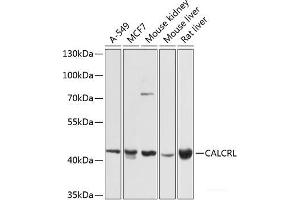 Western blot analysis of extracts of various cell lines using CALCRL Polyclonal Antibody at dilution of 1:1000. (CALCRL anticorps)