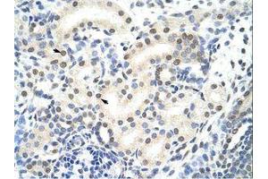 Image no. 1 for anti-Small Nuclear Ribonucleoprotein 70kDa (U1) (SNRNP70) (AA 21-70) antibody (ABIN203140)