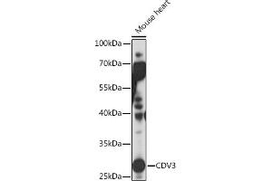 Western blot analysis of extracts of Mouse heart, using CDV3 Rabbit pAb (ABIN7266240) at 1:1000 dilution. (CDV3 anticorps)