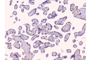 IHC analysis of TNFRSF11B using anti-TNFRSF11B antibody (ABIN7600875).