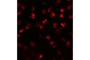 Immunofluorescence (IF) image for anti-ATPase, Ca++ Transporting, Type 2C, Member 2 (ATP2C2) (N-Term) antibody (ABIN1031251)