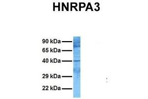 Host:  Rabbit  Target Name:  HNRPA3  Sample Tissue:  Human Jurkat  Antibody Dilution:  1.