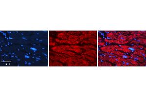 Rabbit Anti-GNS Antibody   Formalin Fixed Paraffin Embedded Tissue: Human heart Tissue Observed Staining: Cytoplasmic Primary Antibody Concentration: 1:100 Other Working Concentrations: N/A Secondary Antibody: Donkey anti-Rabbit-Cy3 Secondary Antibody Concentration: 1:200 Magnification: 20X Exposure Time: 0.