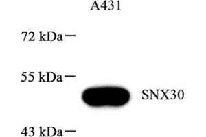 Western blot analysis of SNX30 (ABIN7075693),at dilution of 1: 1000 (SNX30 anticorps)