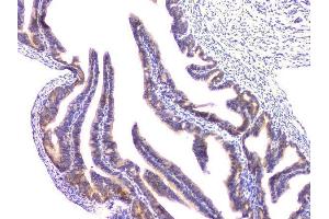 IHC analysis of RAB11B using anti-RAB11B antibody (ABIN6719364). (RAB11B anticorps)